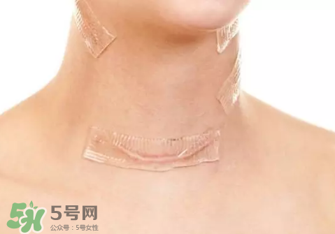 硅膠疤痕貼有用嗎？硅膠疤痕貼效果怎么樣？