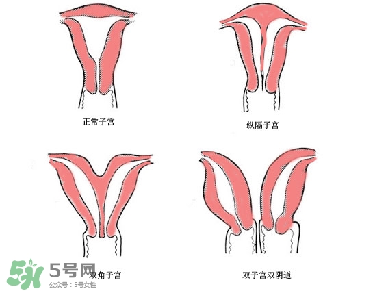 雙子宮是什么意思？雙子宮可以順產(chǎn)嗎？