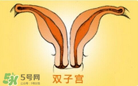 雙子宮是什么意思？雙子宮可以順產(chǎn)嗎？