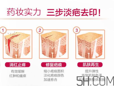 ISDIN怡思丁祛疤膏怎么用？ISDIN怡思丁祛疤膏使用說明