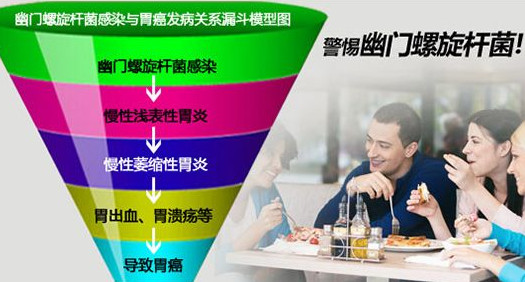幽門螺桿菌的癥狀有哪些表現？幽門螺旋菌怎么治療