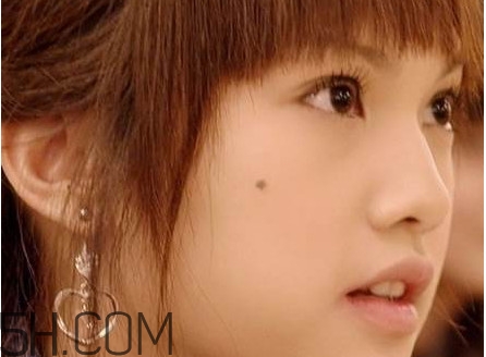 痣是怎么形成的？女人痣長哪里最有福氣