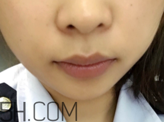 小蜜蜂細致修護唇膏很油嗎？夏天用合適嗎？