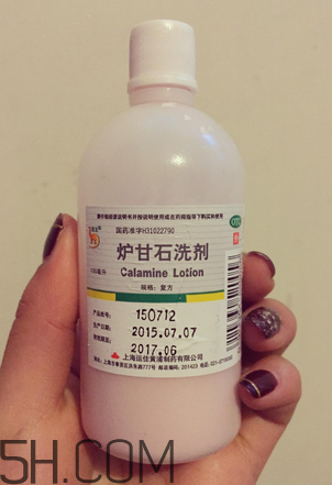 爐甘石洗劑多少錢一瓶？爐甘石洗劑治痤瘡嗎？