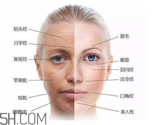 怎么預(yù)防皺紋的產(chǎn)生？導(dǎo)致皺紋的產(chǎn)生的原因有哪些？