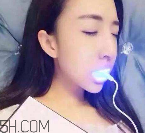 美牙儀可以兩個人用嗎？美牙儀用多久才有作用？