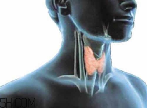 甲狀腺腫大和甲亢的區別有哪些？甲狀腺腫大適合吃什么食物？