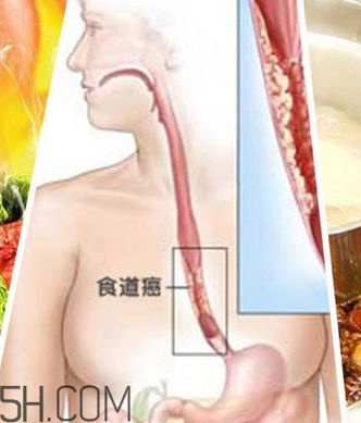 吃太燙會得癌？燙食不僅對胃不好還容易得癌