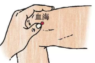 濕疹怎么治才管用？內外同治是關鍵