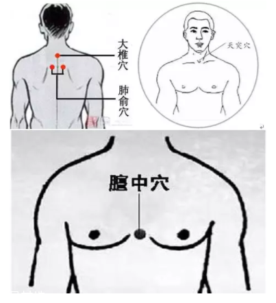 吮痧有什么療效？最溫柔的治病方法
