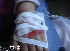 輸液治療不適合哪些病？過敏反應危害大