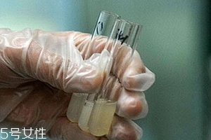 捐精有什么危害？專家稱沒有危害