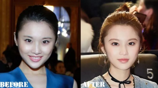 瑯琊榜2張慧雯整容了嗎？換了妝發(fā)美到不認(rèn)識