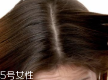 油性頭發(fā)跟什么有關(guān)？離不了這6個原因