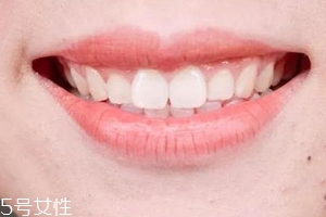 口紅病有哪些癥狀？使用不當(dāng)引發(fā)癌癥