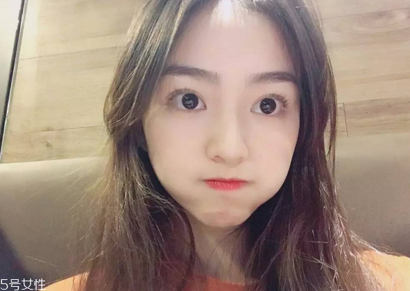 割雙眼皮要注意什么？割雙眼皮充血是正常現(xiàn)象