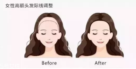 發際線粉填充和發際線筆哪個好？配合使用才最完美
