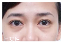 黑眼圈用什么眼霜好？多效護理型眼霜是首選