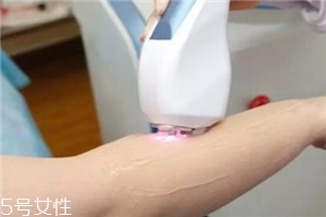 脫毛儀可以脫發際線嗎？脫了還會再長