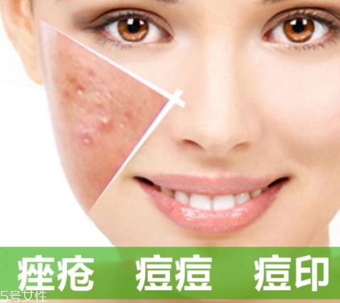 a酸怎么用？a酸怎么建立耐受？