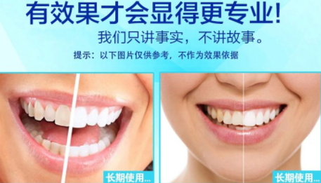 美白牙貼會反彈嗎？牙貼美白效果持續多久