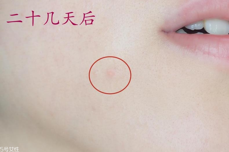 雅詩蘭黛晶透沁白防曬搖搖乳成膜快嗎？適合油痘皮嗎？