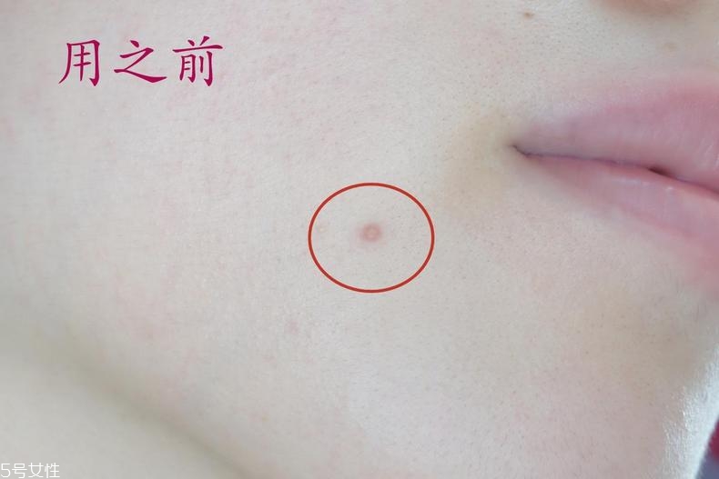 雅詩蘭黛晶透沁白防曬搖搖乳成膜快嗎？適合油痘皮嗎？