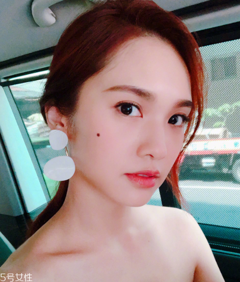 點痣能吃芒果嗎 芒果是發物不建議吃