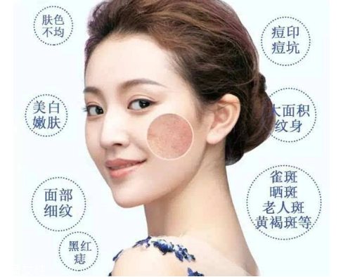 皮秒會反黑嗎 這是正常現象