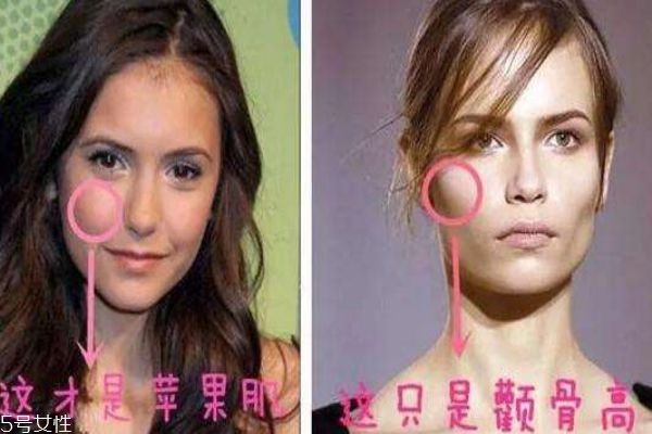蘋果肌和顴骨高區別 別再傻傻分不清楚