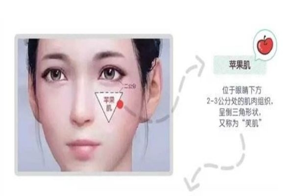 蘋果肌和顴骨高區別 別再傻傻分不清楚