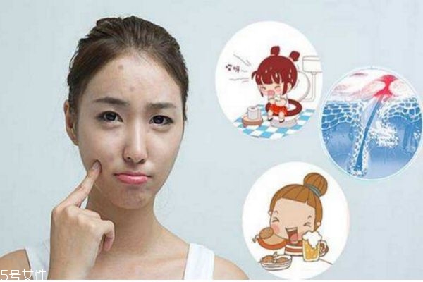 經常熬夜臉上長痘痘怎么辦 熬夜起痘痘怎么調理