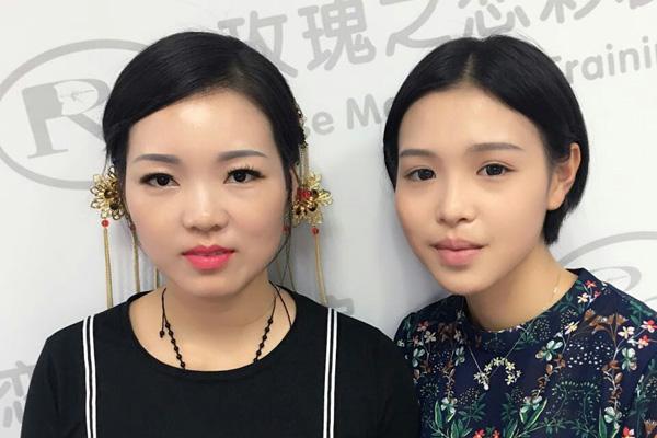 上瞼松弛變美術是什么 上瞼松弛變美術術前要注意什么