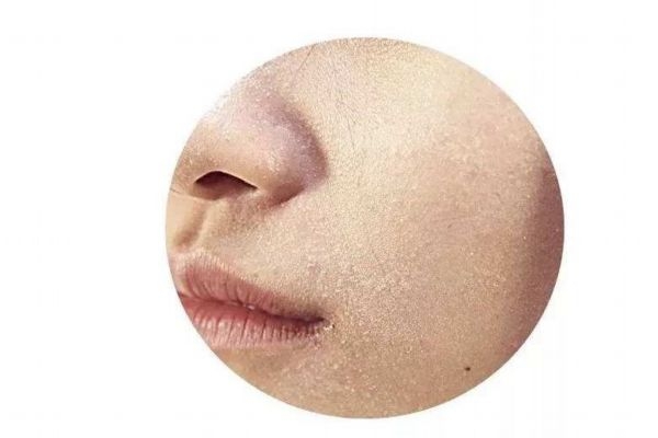 究竟什么是角質層呢 角質層到底要不要去呢
