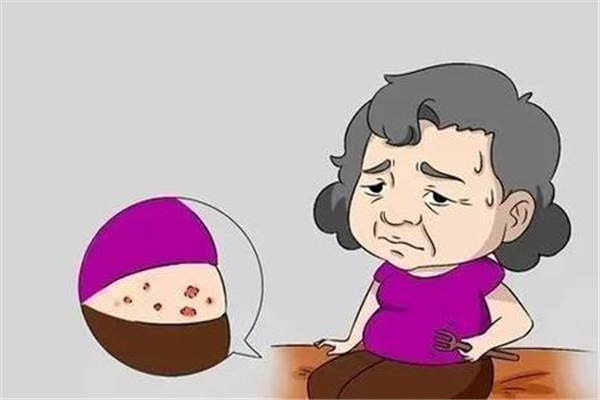 蕁麻疹會引起頭皮癢嗎 蕁麻疹有什么表現癥狀