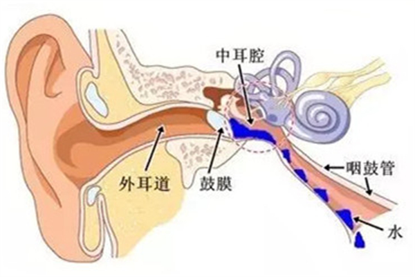 中耳炎癥狀表現有哪些 中耳炎是耳膜破了嗎