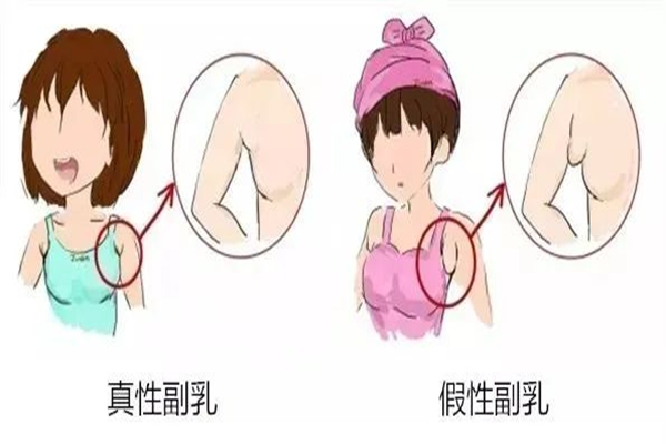 副乳是贅肉嗎 副乳跟贅肉的區別