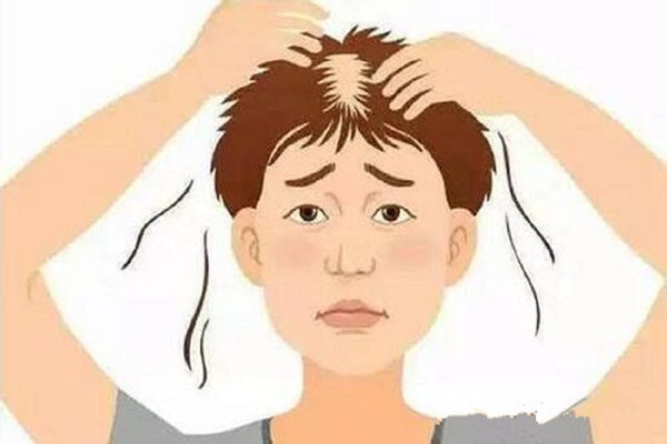 神經性脫發的癥狀表現 神經性脫發怎么調節