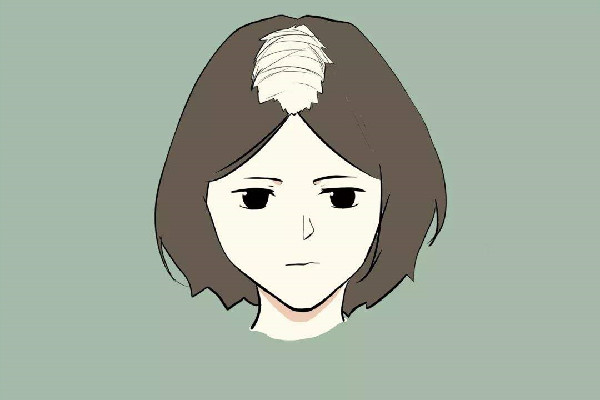 發際線會長回來嗎 發際線和年齡有關系嗎