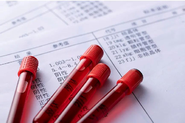 醫生飛針采血被贊“蚊子投胎” 采血都能檢查出來什么